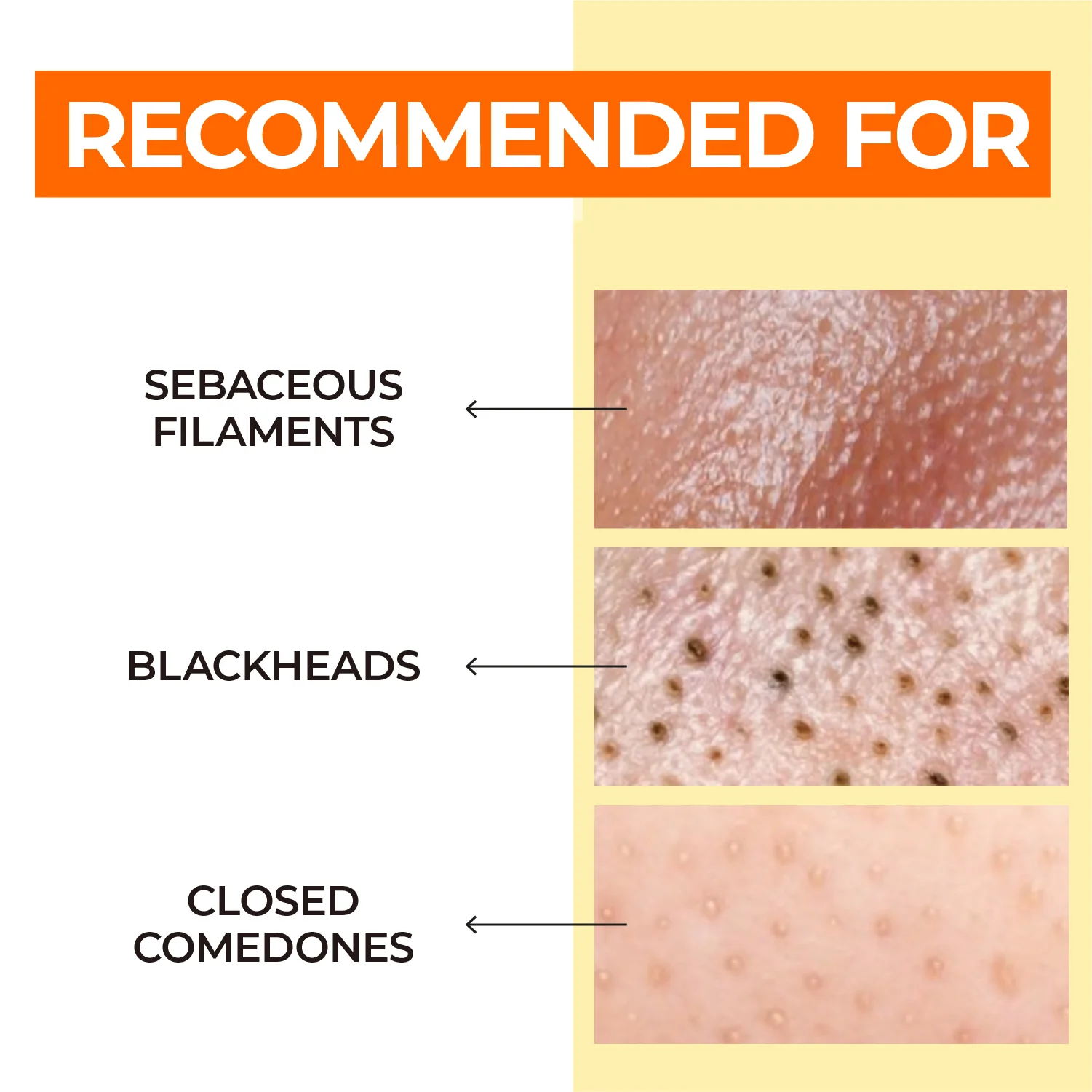 No.1 Easy Peasy Cleansing Oil - Image 4