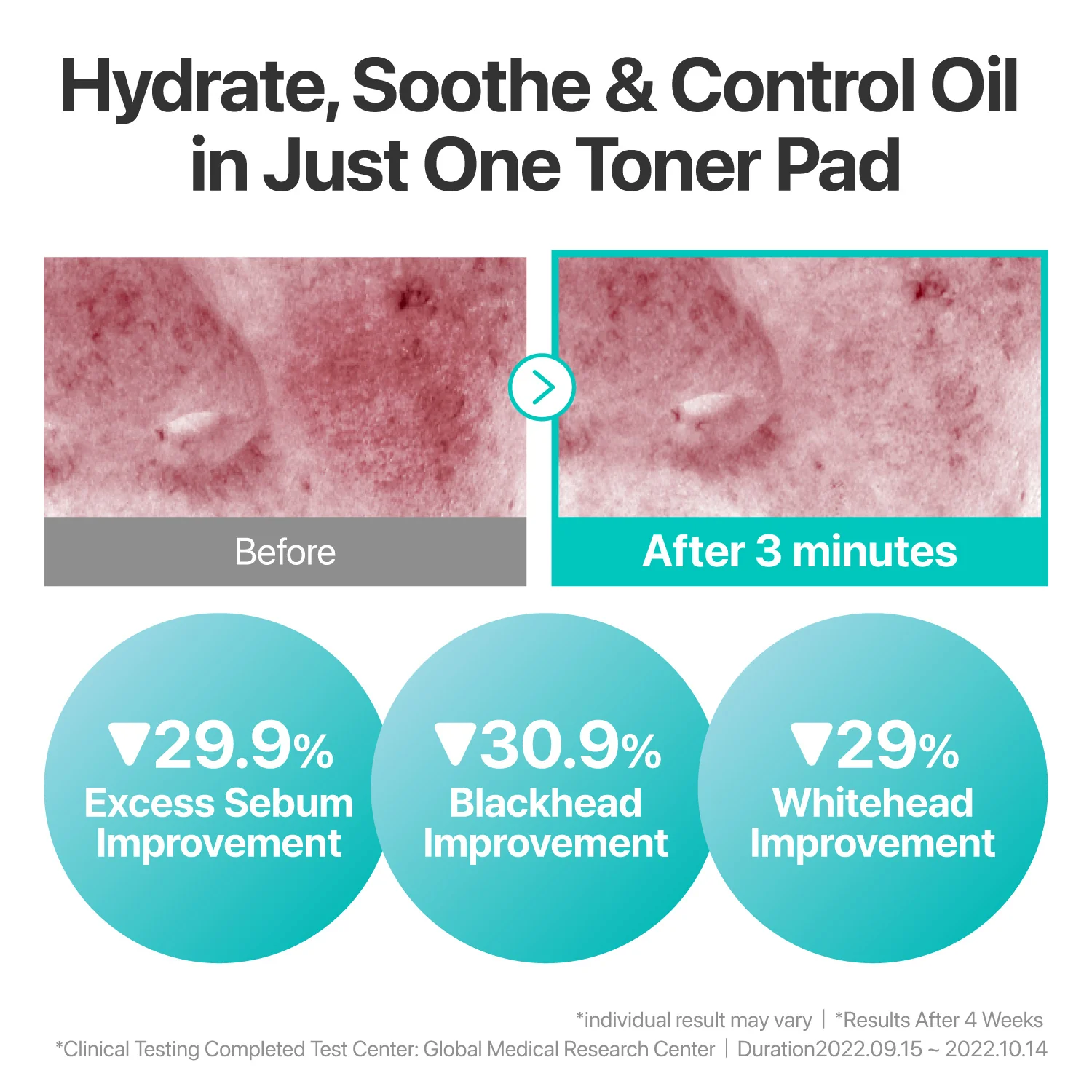 No.1 Hydration Calming Duo - Image 4