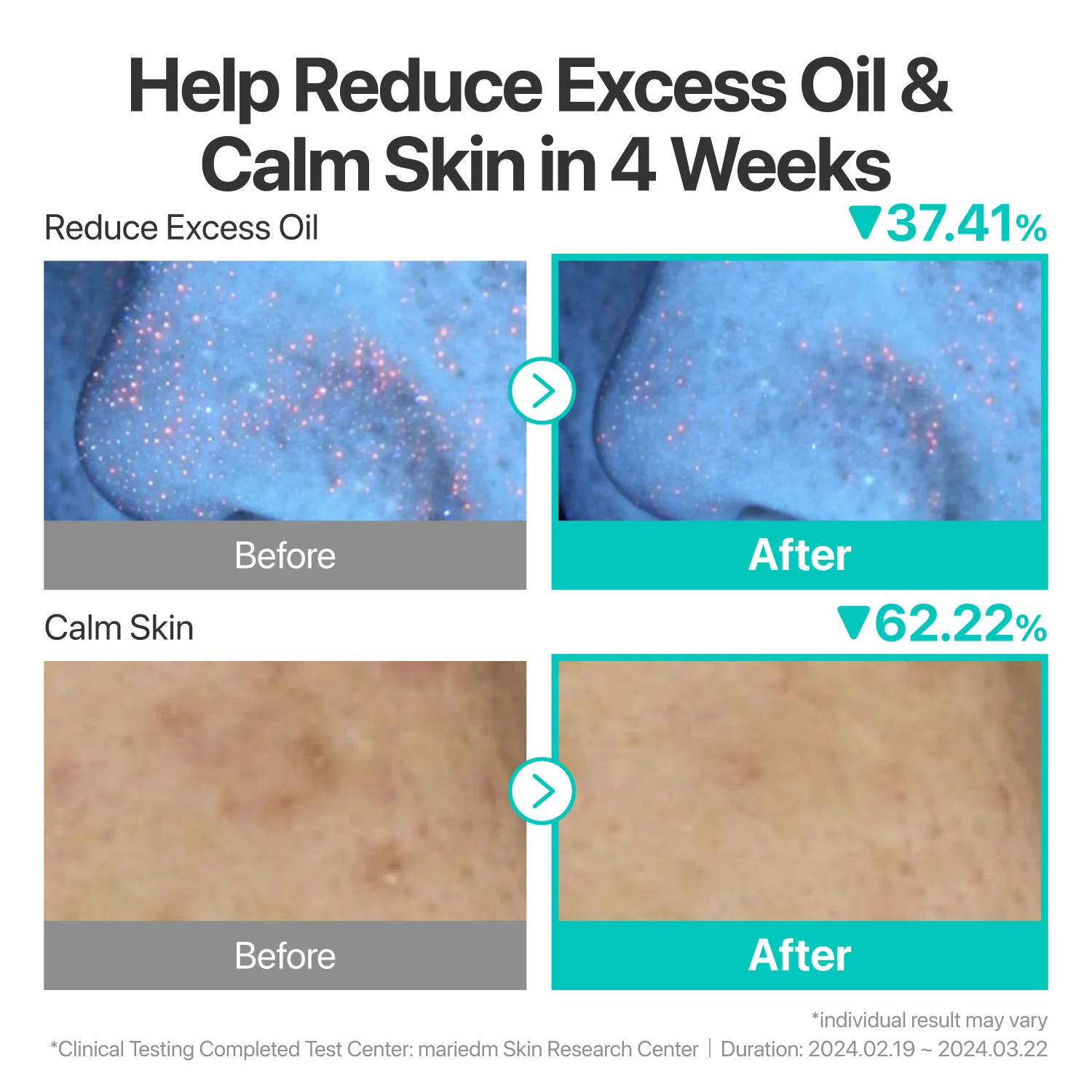 No.1 Hydration Calming Duo - Image 6