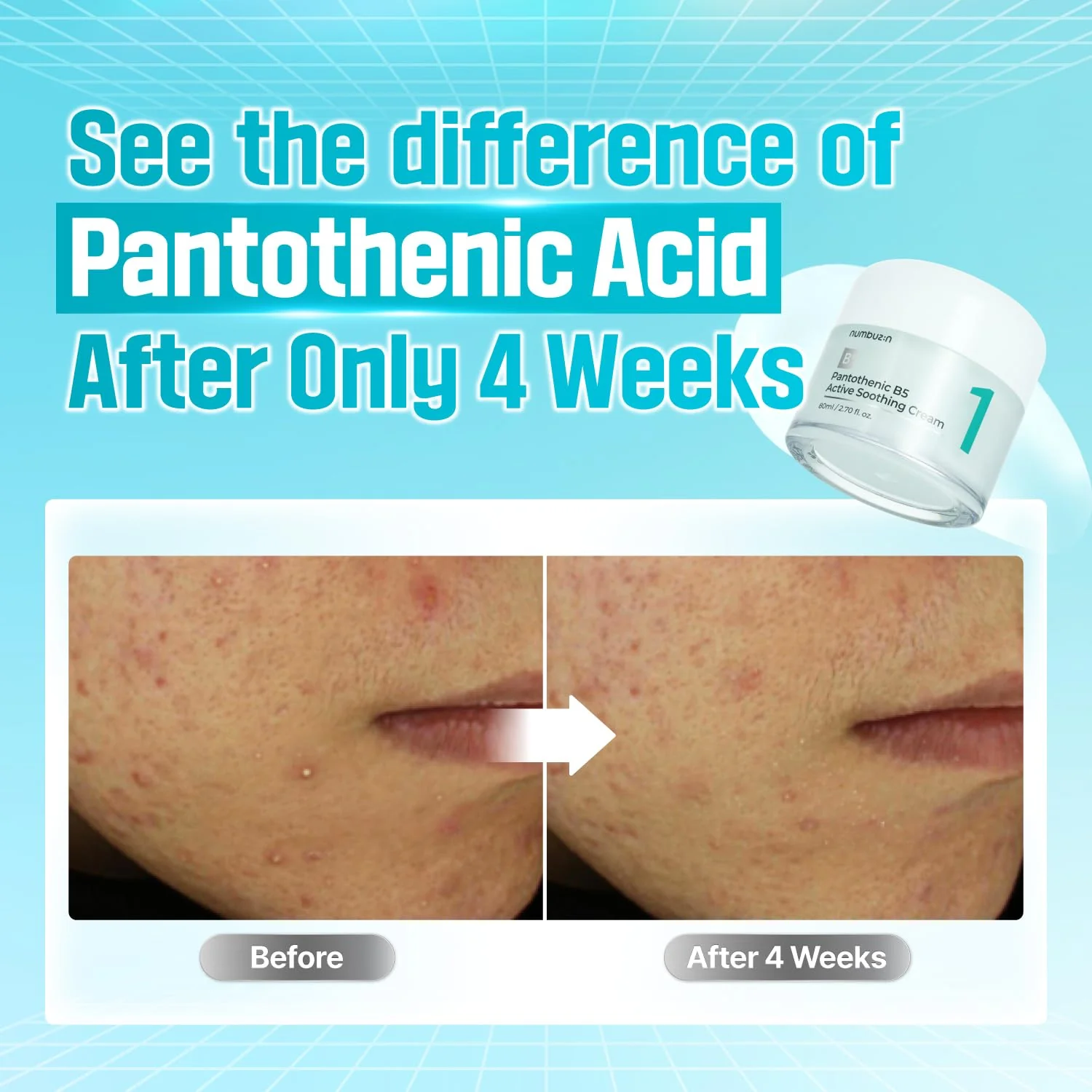 No.1 Pantothenic B5 Active Soothing Cream - Image 4