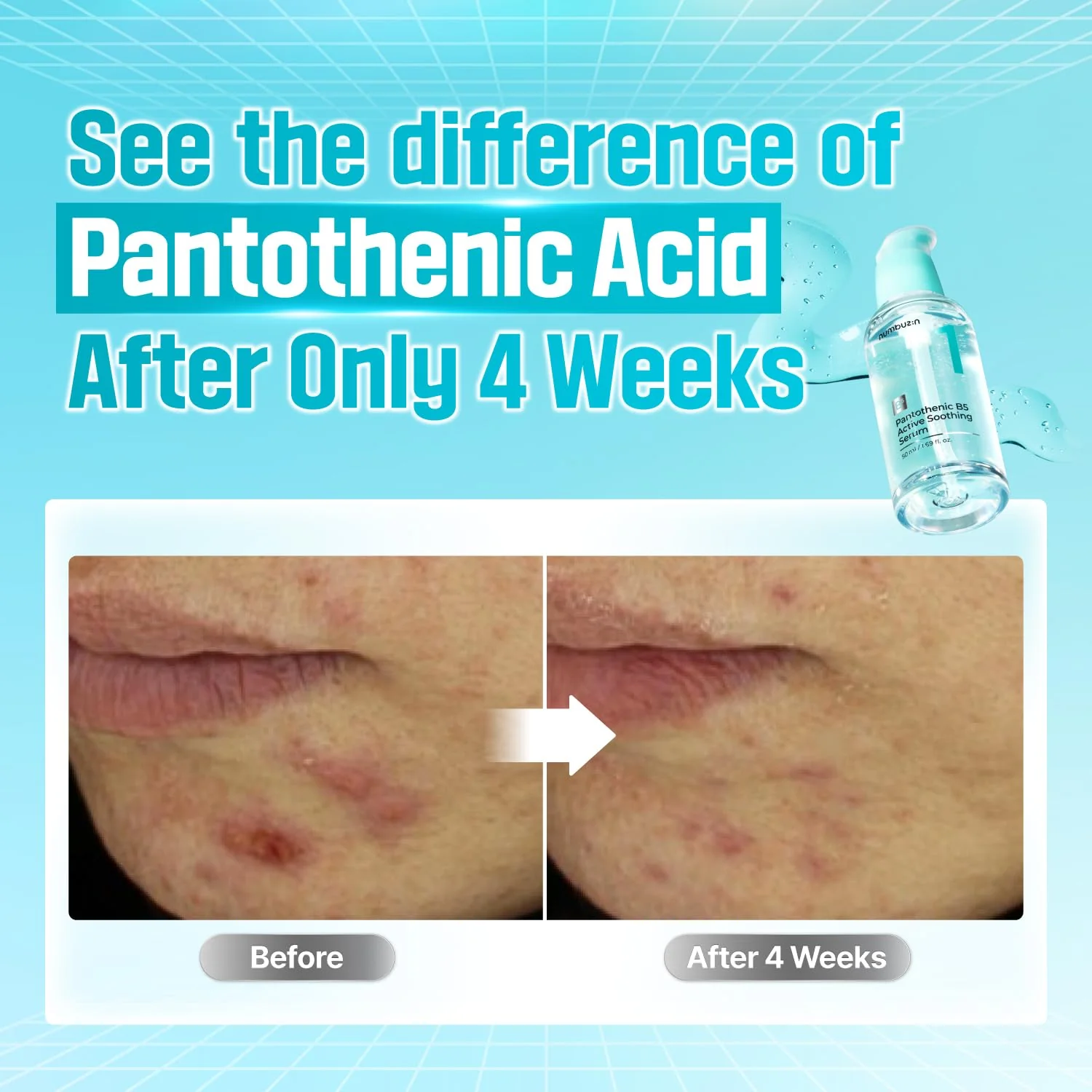 No.1 Pantothenic B5 Active Soothing Serum - Image 4