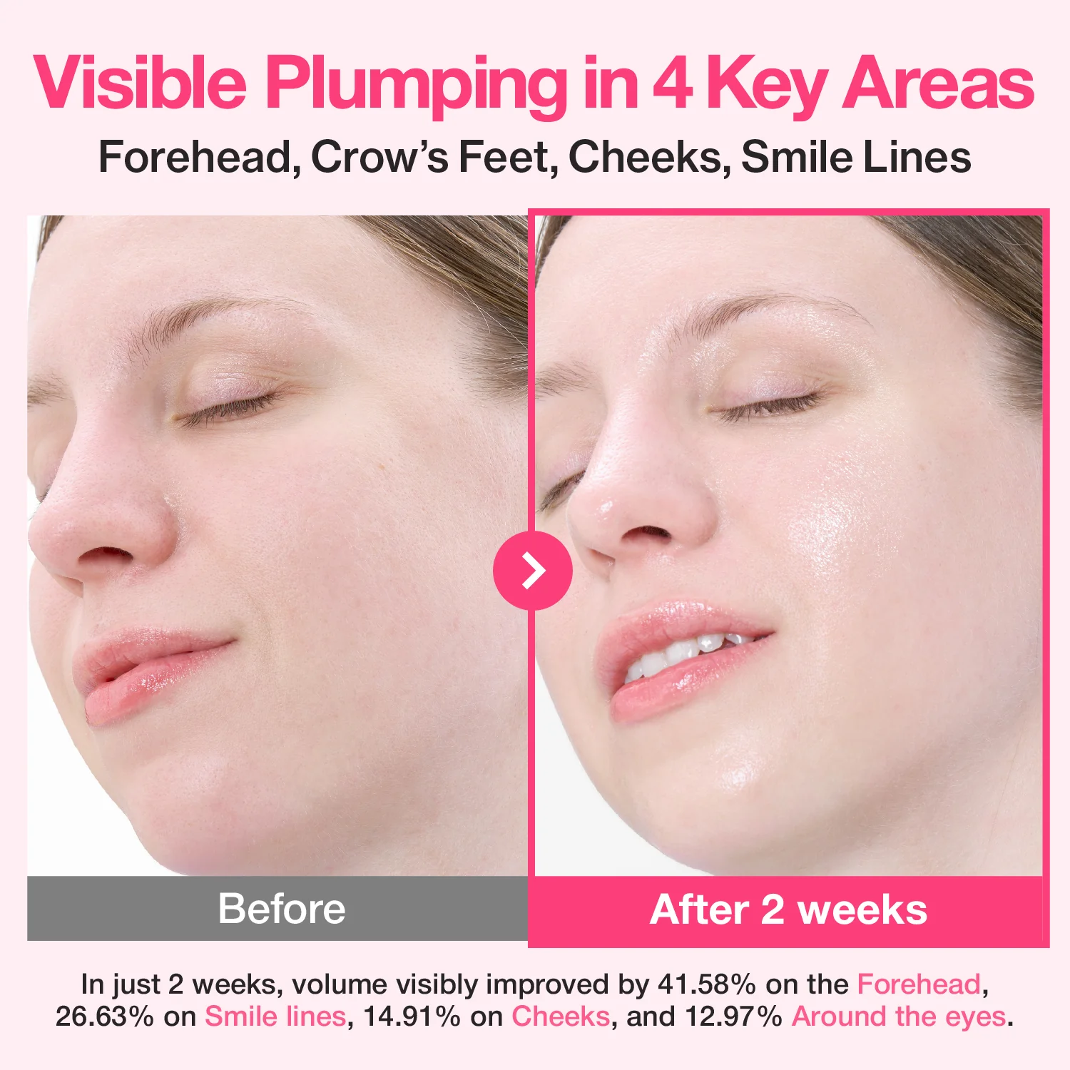 No.2 Rose PDRN Collagen Plumping Serum - Image 4
