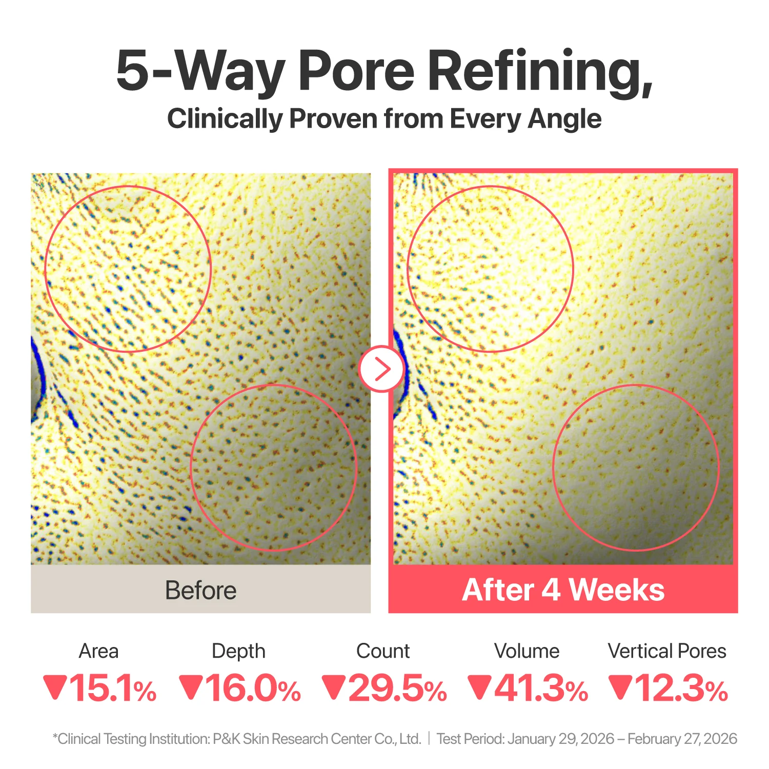 No.3 Bifida Bakuchiol Zero Pore Cleansing Oil - Image 5