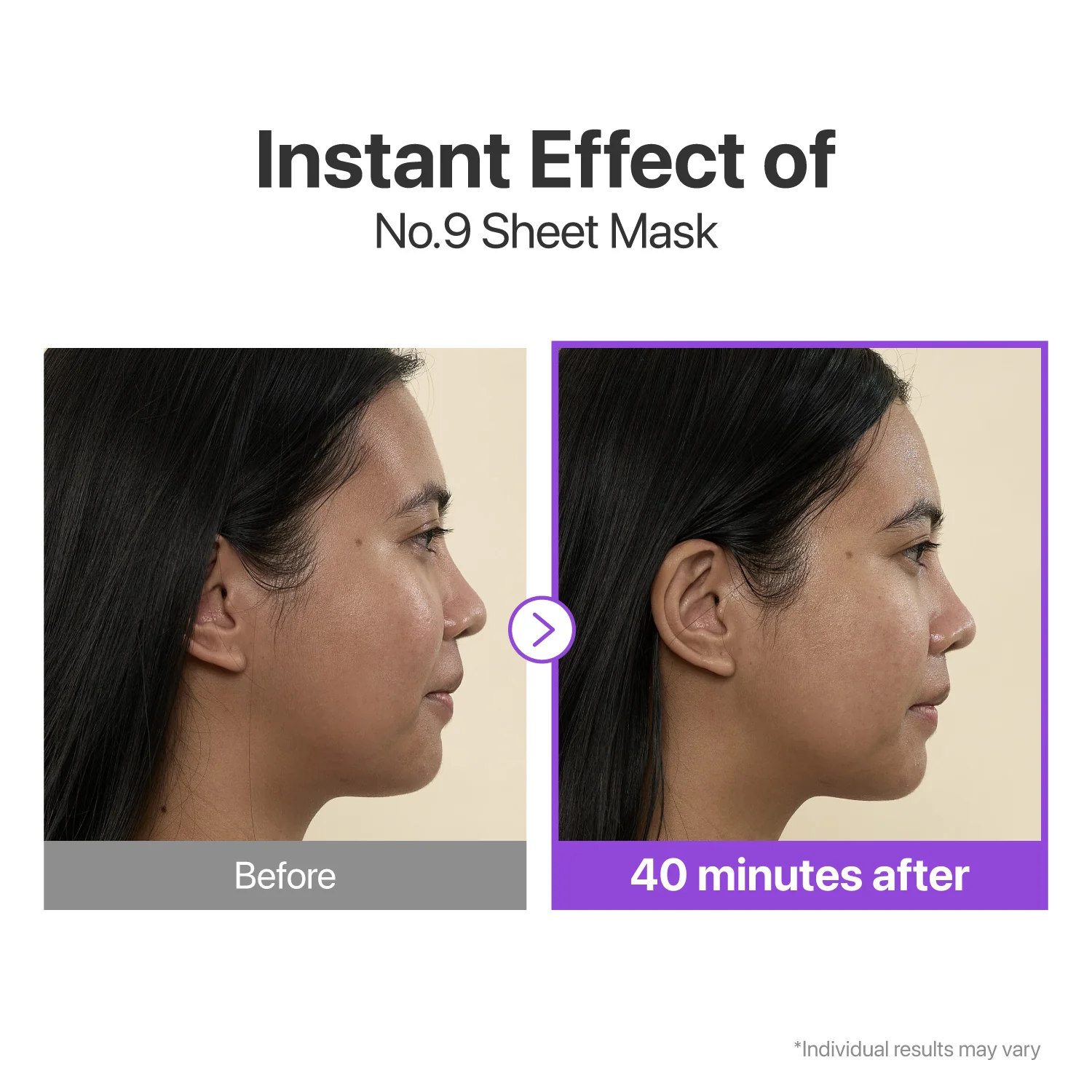 No.9 NAD+ BIO Lifting-sil Full Face Mask (4 Sheets + Lifting Band) - Image 5