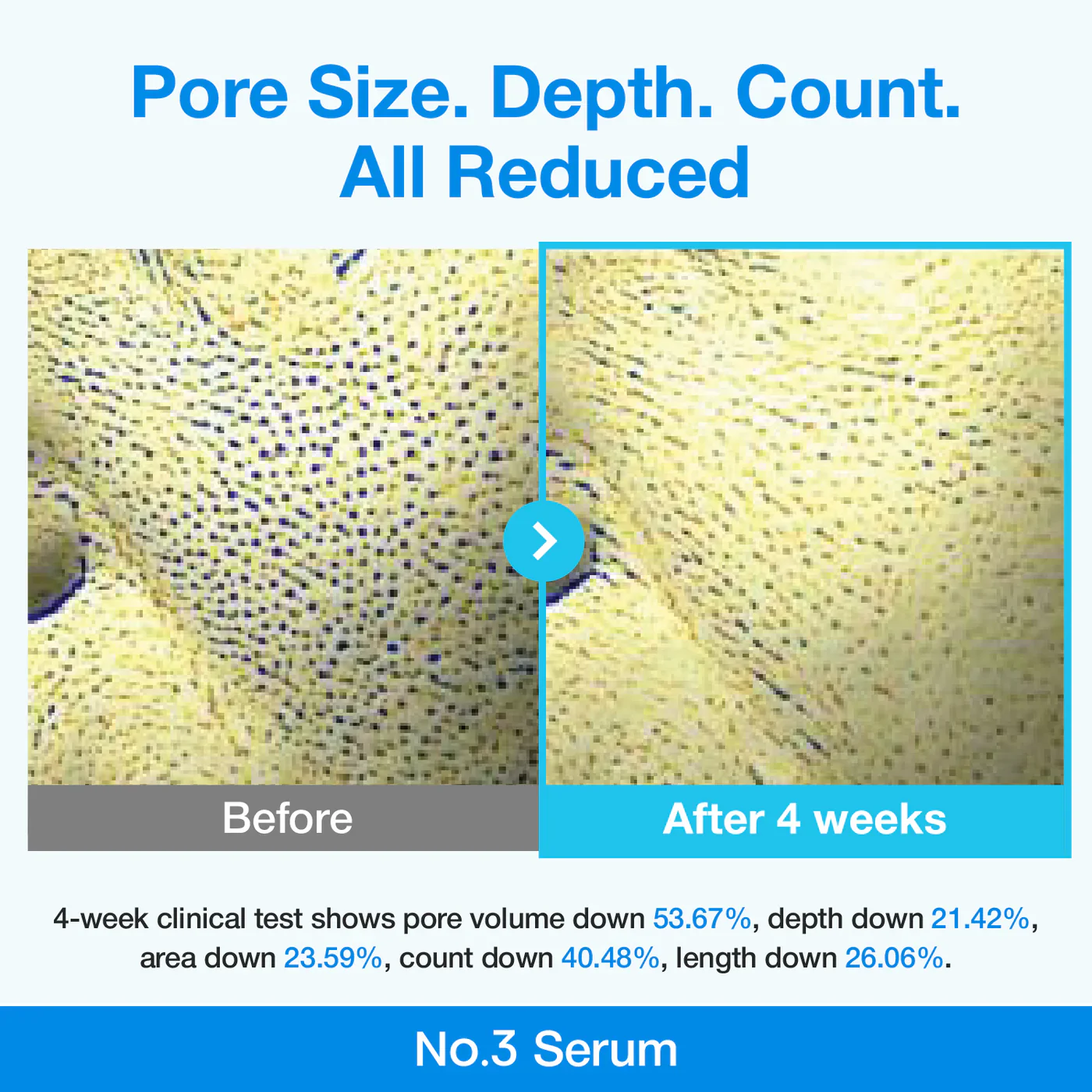 Pore Tightening Routine Set - Image 14