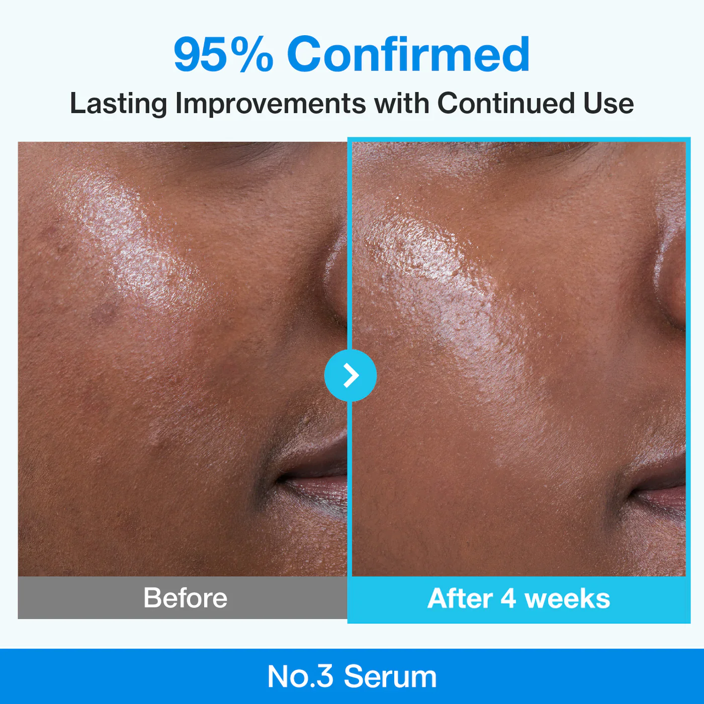 Pore Tightening Routine Set - Image 15