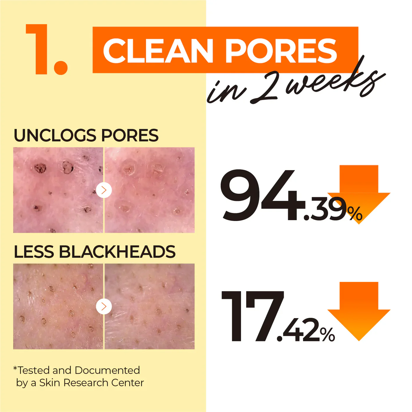 Pore Tightening Routine Set - Image 6