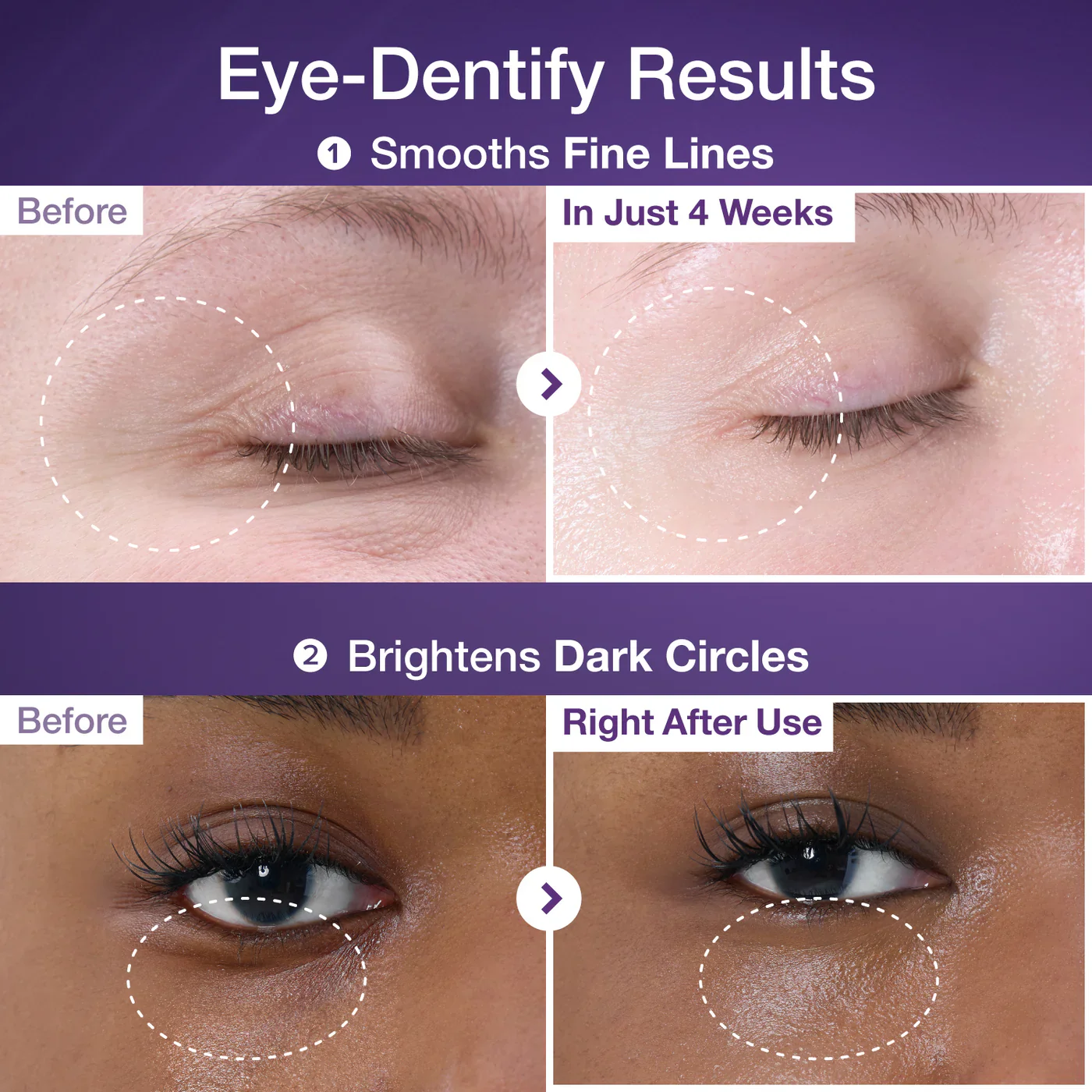 Special Eye Treatment Set - Image 5